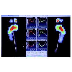 unas plantillas personalizadas se obtiene con una buena huella plantar.